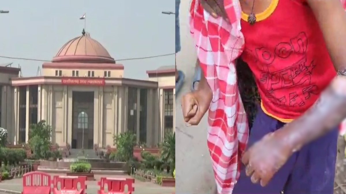 खौलती खीर में छात्र के गिरने के मामले पर हाईकोर्ट ने लिया संज्ञान, कलेक्टर से शपथ पत्र में मांगा जवाब