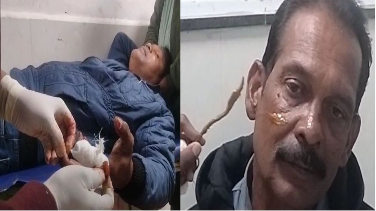 मौत का मांझाः चाइना मांझा से पतंगबाजी में दो लोग घायल, दोनों अस्पताल में भर्ती, जिम्मेदार बोले- करेंगे कार्रवाई