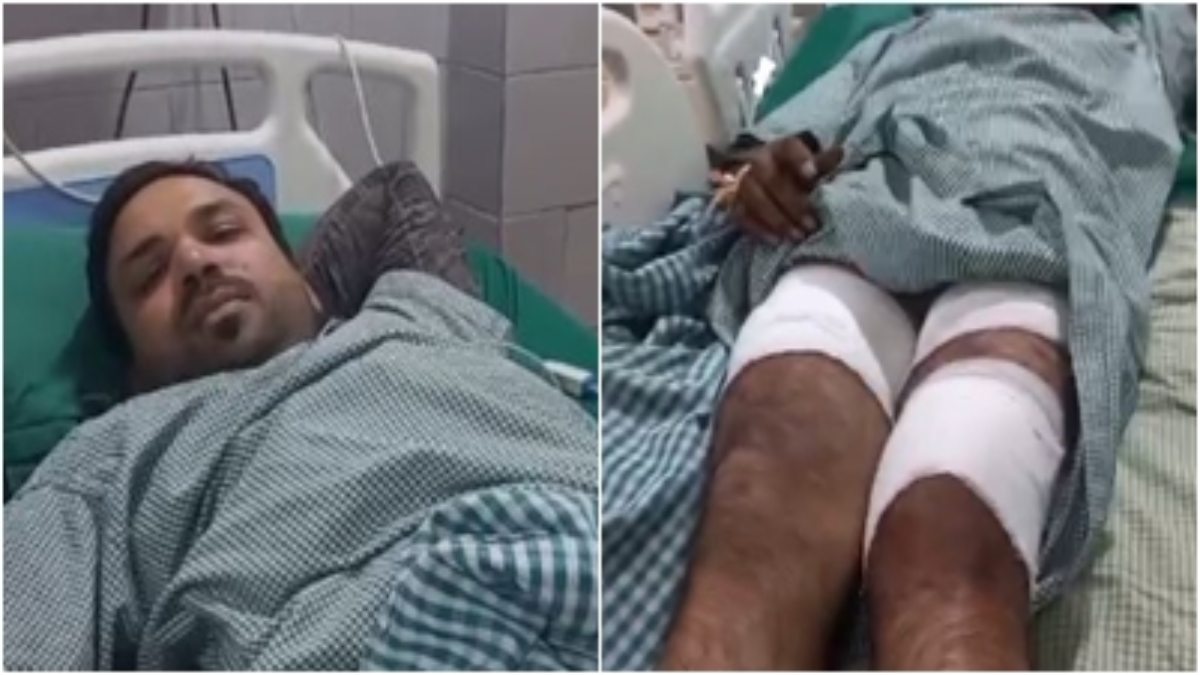 MP CRIME: कार सवार बदमाशों ने युवक को चाकू से गोदा, आरोपी फरार, CCTV खंगाल रही पुलिस  
