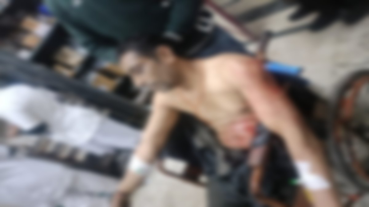 MP CRIME NEWS: बदमाशों के हौसले बुलंद, सरेराह युवक को चाकुओं से गोदा, Video हुआ वायरल