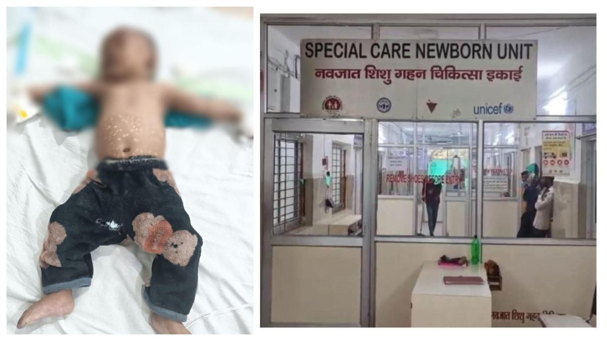 फिर अंधविश्वास में क्रूरता: गर्म सलाखों से मासूम को दागा, 3 माह की बच्ची की हुई मौत