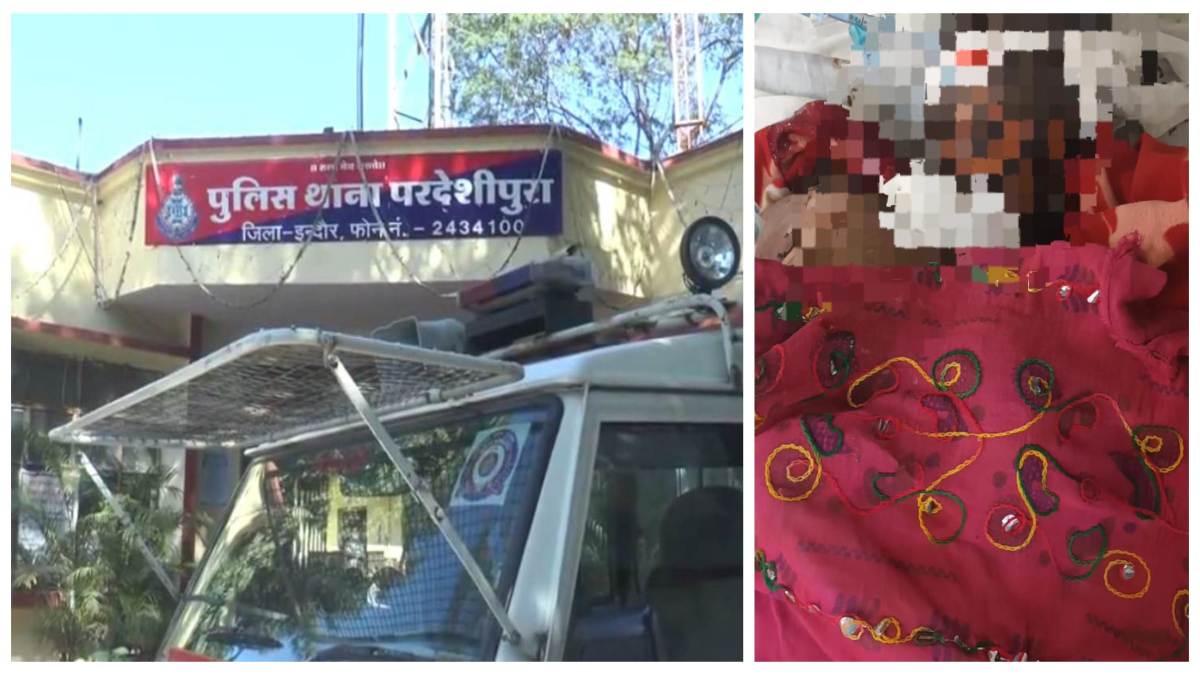 शराब पीकर घर पहुंचा पति की पत्नी से हुई जमकर लड़ाई, आगजनी में दोनों घायल, इलाज जारी