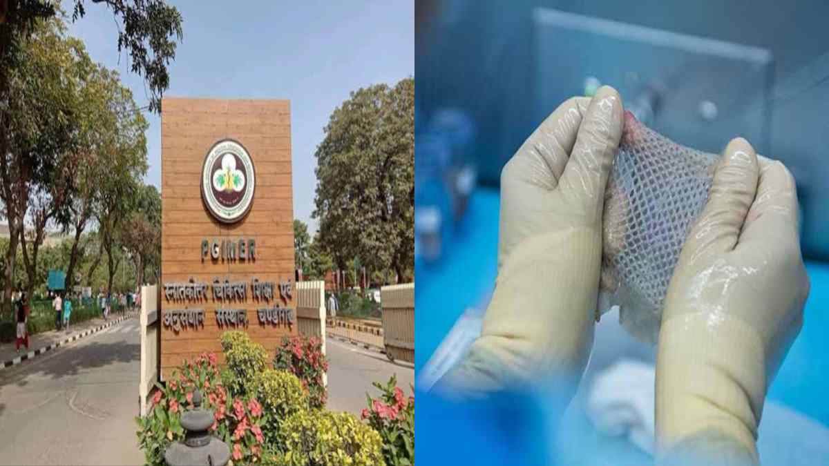 Punjab में खुला पहला Skin Bank, 50% से ज्यादा जले मरीजों को मिलेगा नया जीवन, ब्रेन डेड भी कर सकते हैं स्किन Donate