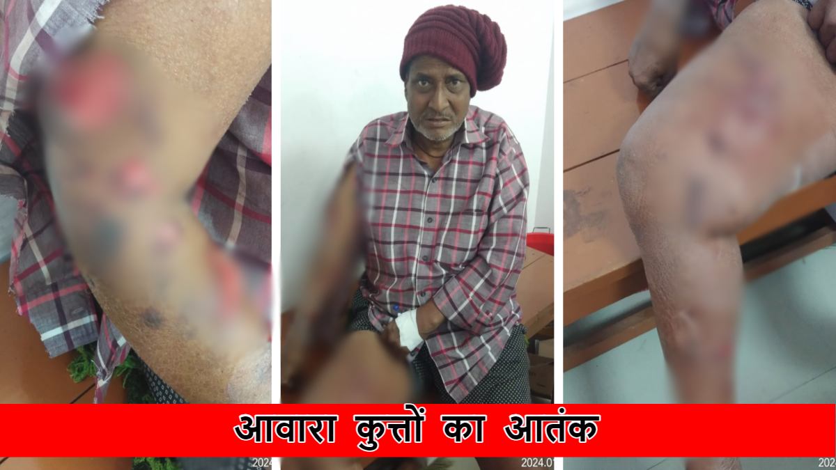 जबड़े में जान! आवारा कुत्तों ने 63 वर्षीय बुजुर्ग पर किया हमला, लहूलुहान शरीर पर लगे 100 से अधिक टांके, खौफ में शहरवासी…