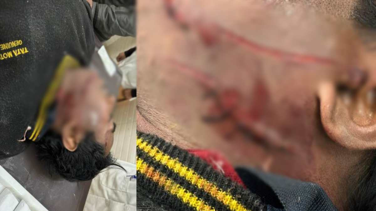 CG में खौफनाक हमलाः एक युवक ने दूसरे पर किया ब्लेड से हमला, मारे कई कट, जानिए आखिर क्यों दिए गहरे जख्म…