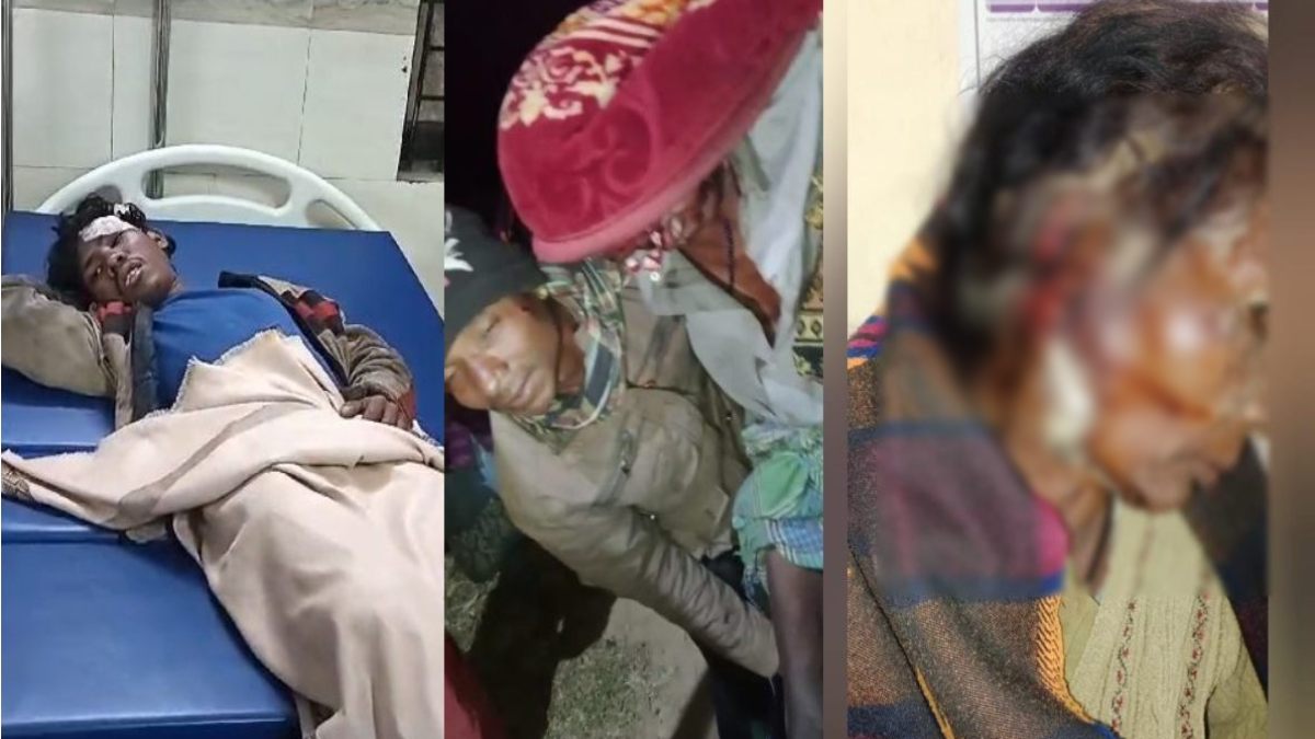 मोबाइल के लिए खूनी संघर्ष : मोबाइल चोरी का आरोप लगा तो युवक ने चाचा समेत परिवार के 3 लोगों पर किया जानलेवा हमला, दो की हालत गंभीर