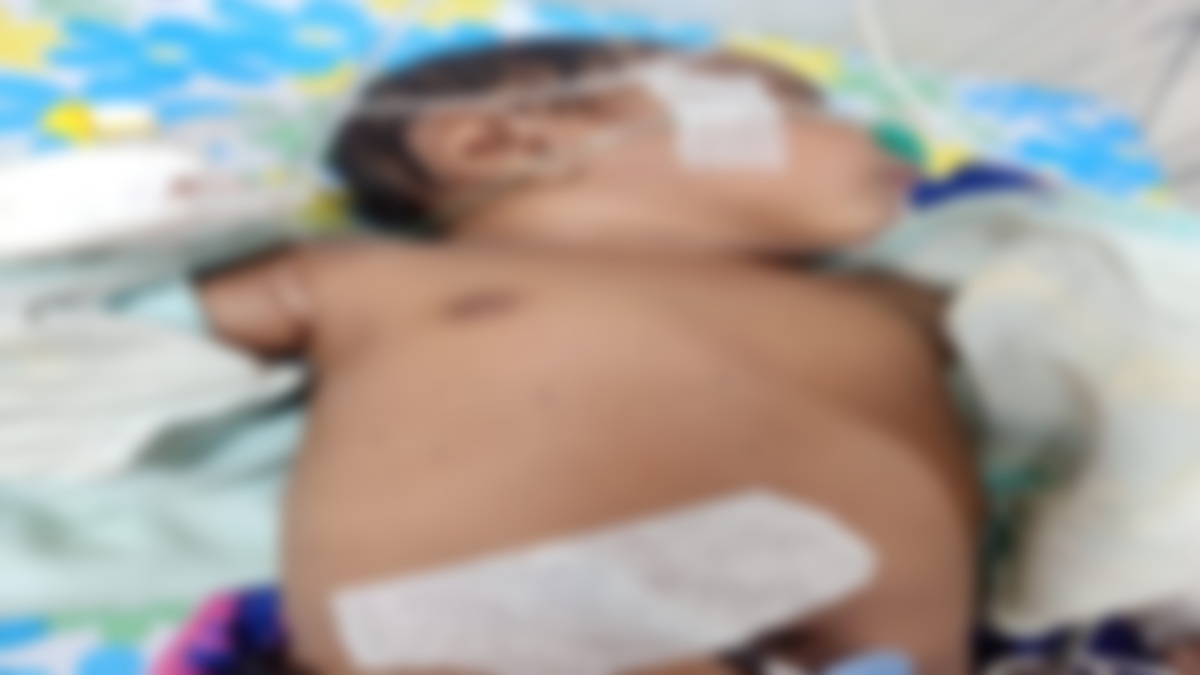मासूमों को गर्म सलाखों का टॉर्चर: फिर अंधविश्वास की भेंट चढ़ी मासूम, 2 माह की बच्ची की मौत