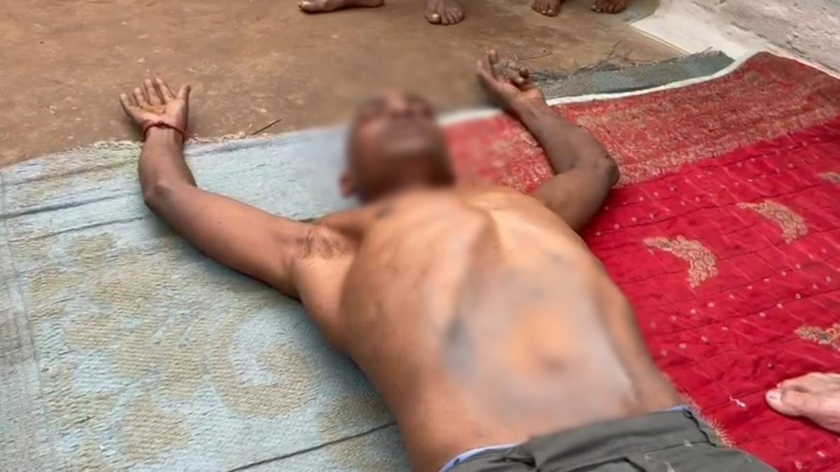 कब होगी बंद दागने की कुप्रथा ? पेट दर्द की शिकायत पर युवक के पेट में दागा गया गर्म हंसिया, वीडियो वायरल