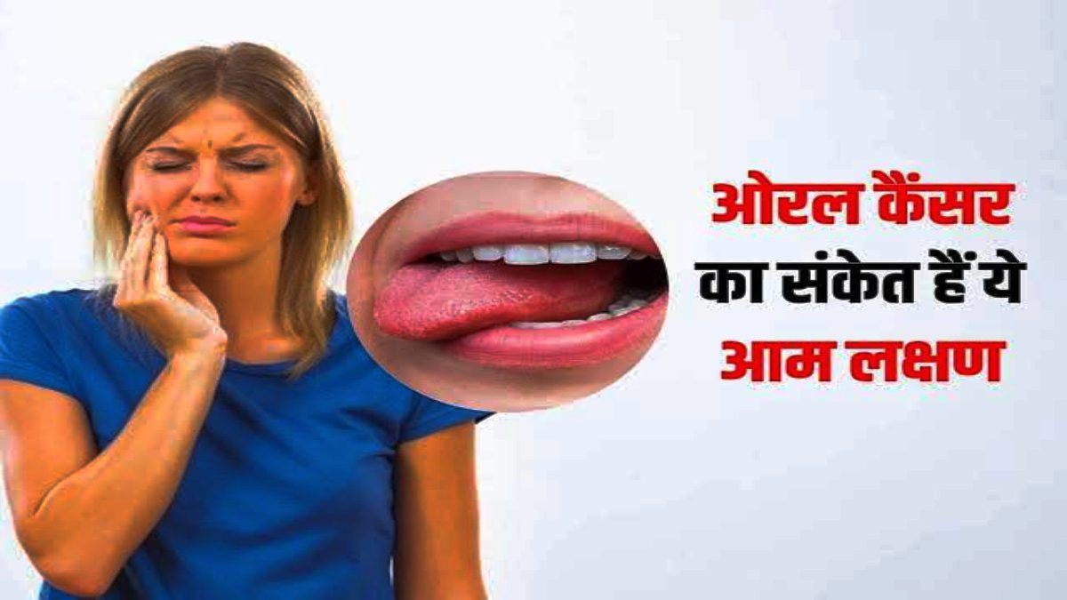 Health Tips : Oral Cancer के ये हैं शुरुआती लक्षण, अगर आपको भी दिखें इनमें से कोई तो तुरंत जाएं डॉक्टर के पास