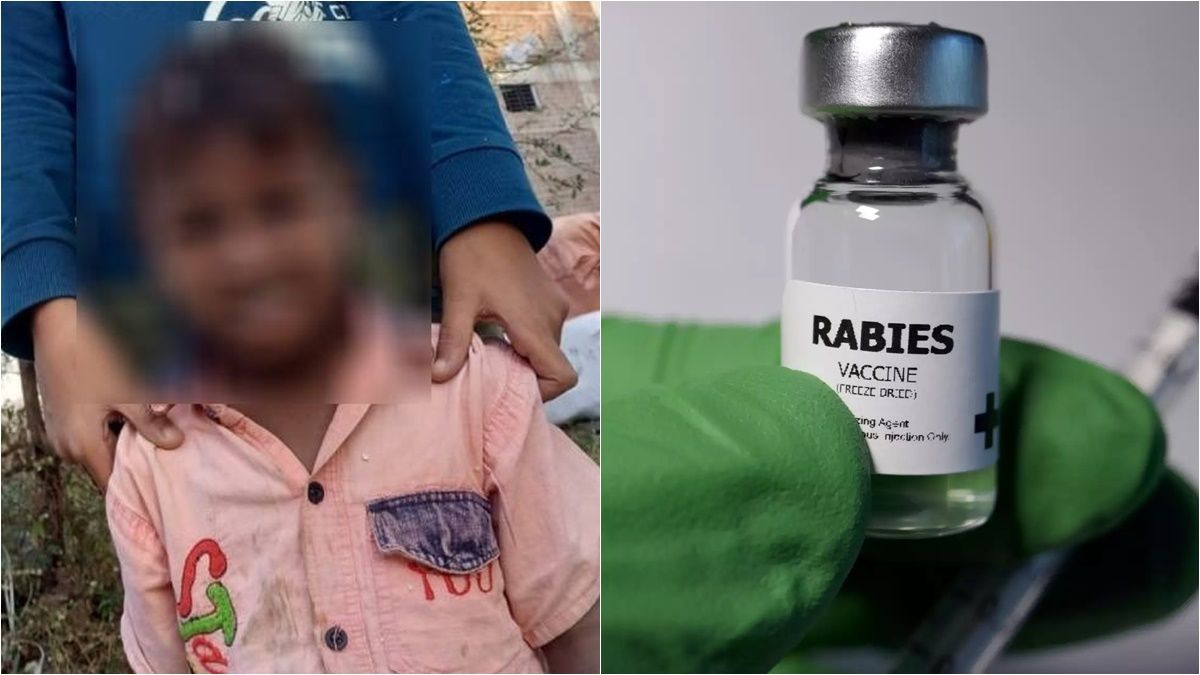 खबर का असर: कुत्ते के काटने से मासूम की मौत का मामले में मानव अधिकार आयोग ने लिया संज्ञान, इन अधिकारियों से 3 सप्ताह में मांगा जवाब