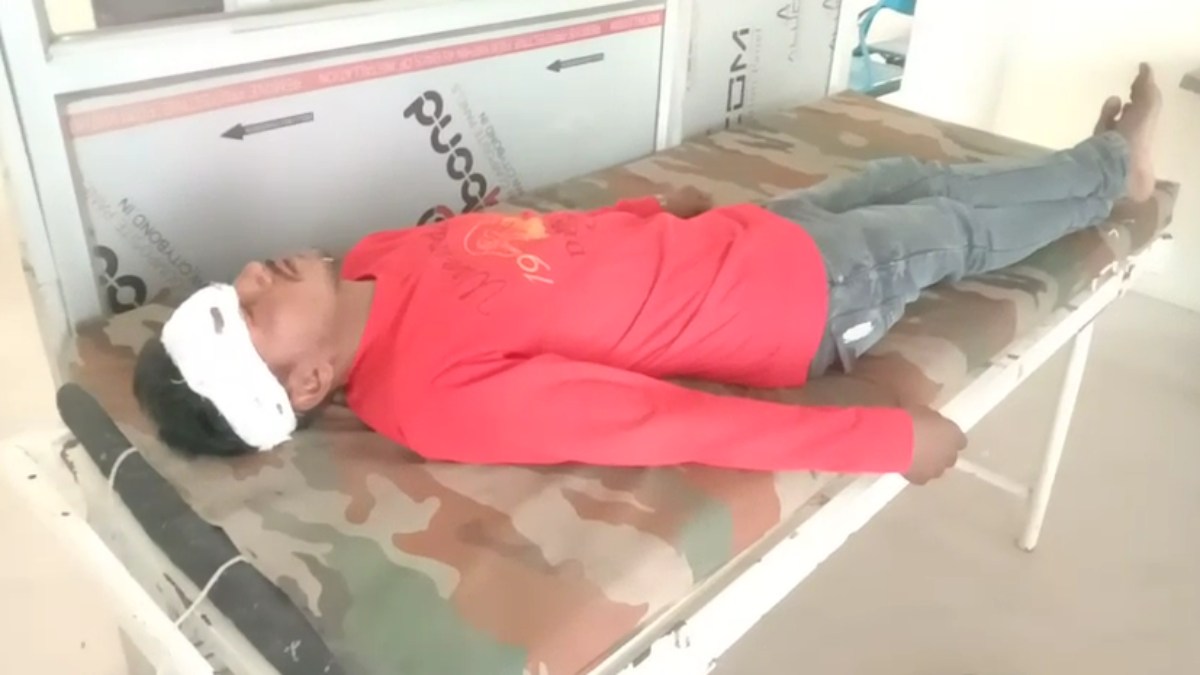 उधारी के पैसे मांगना युवक को पड़ा महंगा: बदमाश ने पत्थर से किया जानलेवा हमला, पीड़ित अस्पताल में भर्ती