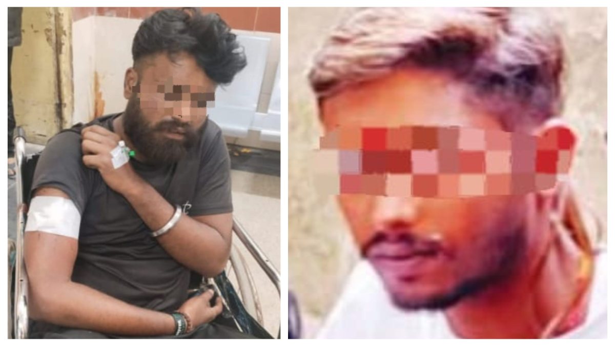 दो पक्षों के मामूली विवाद में चली बंदूक, एक युवक हुआ घायल, जांच में जुटी पुलिस