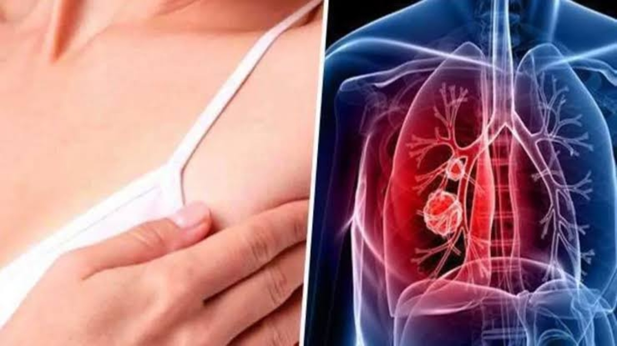 Breast And Lung Cancer Cases: पुरुषों में फेफड़े और महिलाओं में ब्रेस्ट कैंसर का खतरा सबसे अधिक बढ़ने की संभावना: WHO