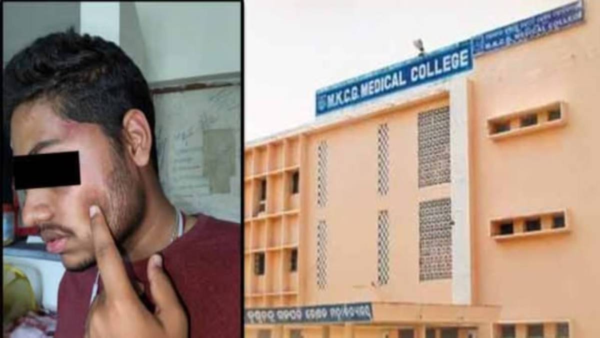 Odisha News : एमकेसीजी मेडिकल कॉलेज में रैगिंग, सीनियर छात्रों ने की छात्र की पिटाई