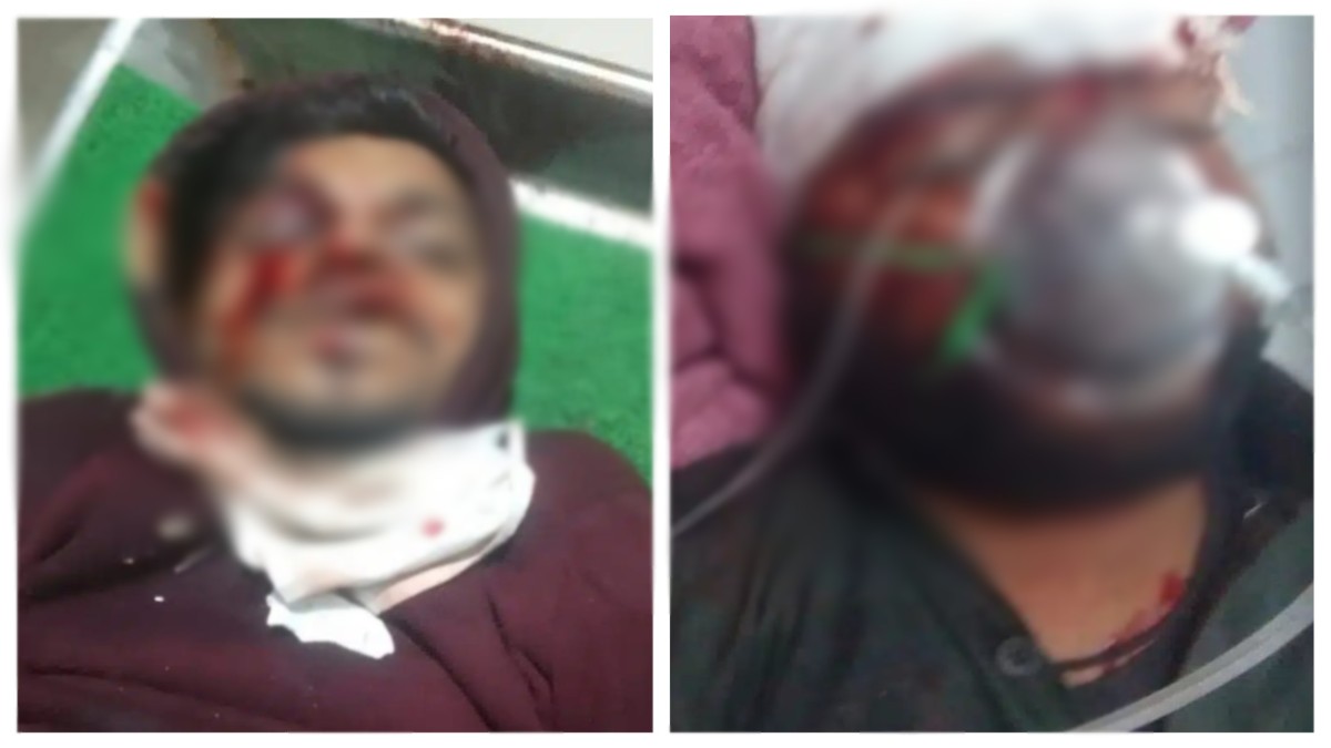 Road Accident: शराब के नशे में स्कूटी चलाना पड़ा भारी, दर्दनाक हादसे में एक की मौत, दो घायल
