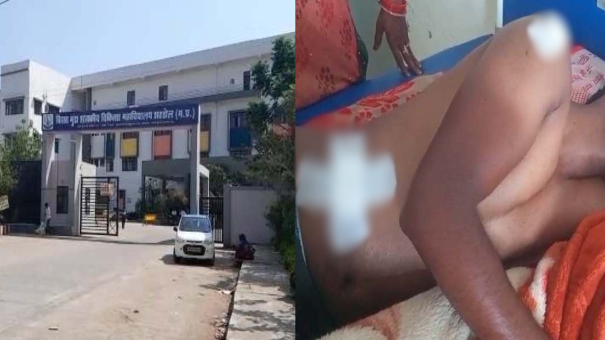 शादी समारोह में युवक पर चाकू से जानलेवा हमला: अस्पताल में जिंदगी और मौत की जंग लड़ रहा पीड़ित, बदमाशों की तलाश जारी
