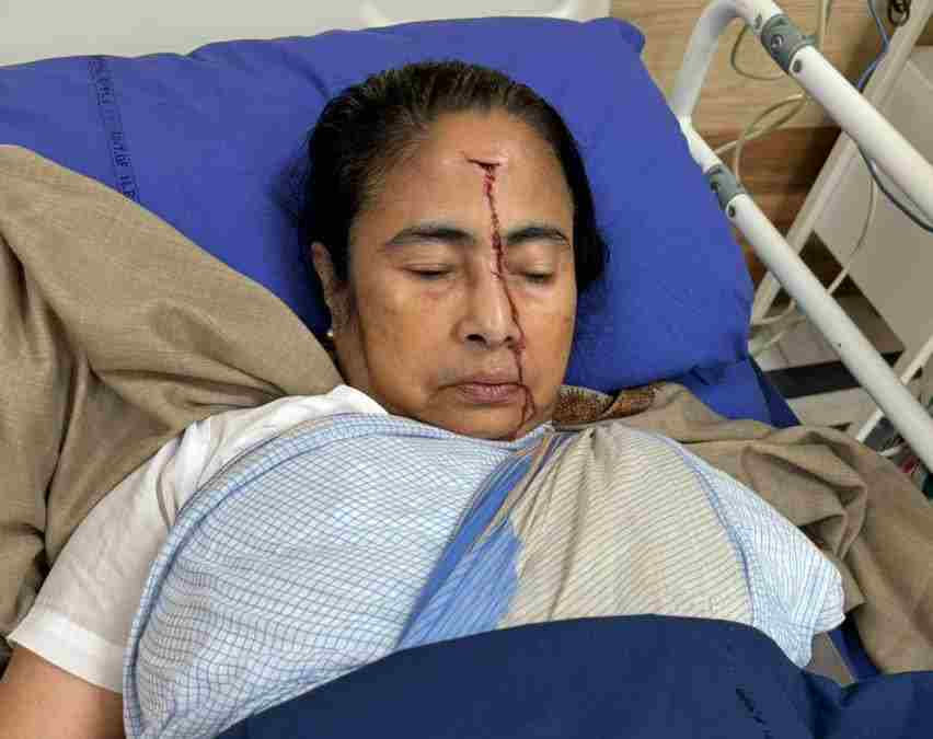 सीएम ममता बनर्जी को सिर पर लगी गंभीर चोट, TMC ने दी जानकारी, कहा – सभी दुआ कीजिए…