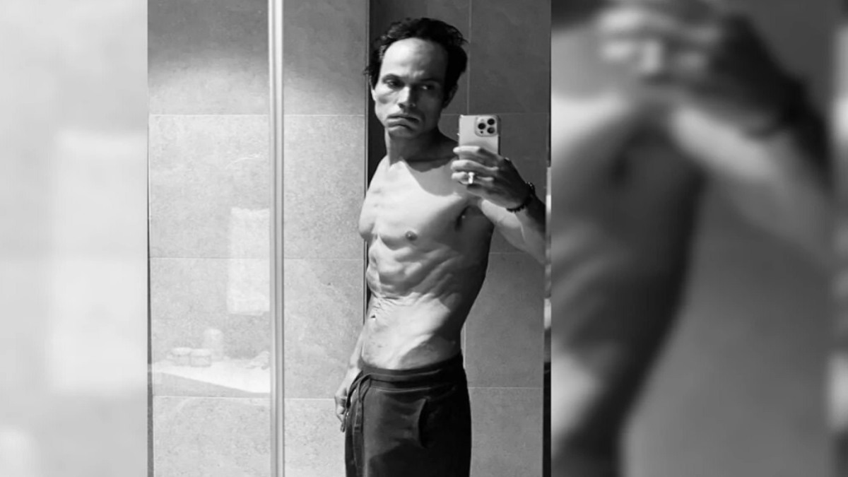 ये कैसा हो गया Randeep Hooda का हाल, ट्रांसफॉर्मेशन देख फैंस हुए शॉक्ड, पहचानना हुआ मुश्किल …