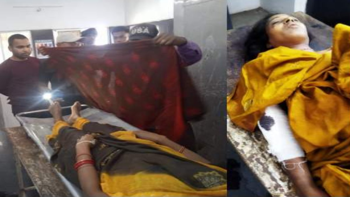 Anuppur News: करंट लगने से उपसरपंच की पत्नी की मौत, इधर पेड़ से गिरी महिला ने इलाज के दौरान तोड़ा दम