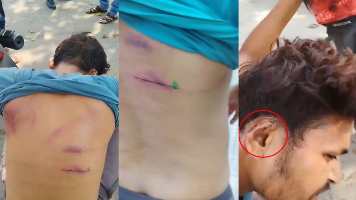 वर्दी में गुंडागर्दी : नहीं मिला आरोपी तो उसके भाई को बेरहमी से पीटा, शरीर में आए गंभीर चोट, प्रशिक्षु डीएसपी को SP ने किया लाइन अटैच