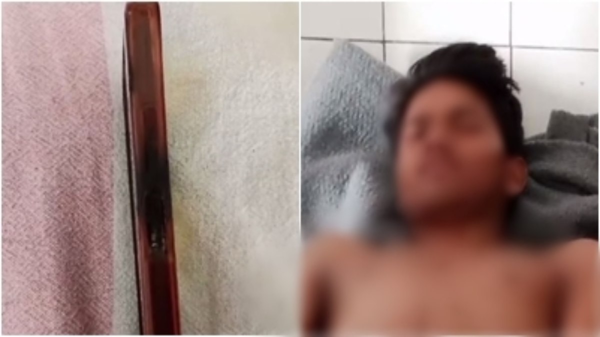 सावधान! चार्जिंग के दौरान मोबाइल पर बात करना युवक को पड़ा भारी, अचानक ब्लास्ट के बाद हुआ ये हाल 