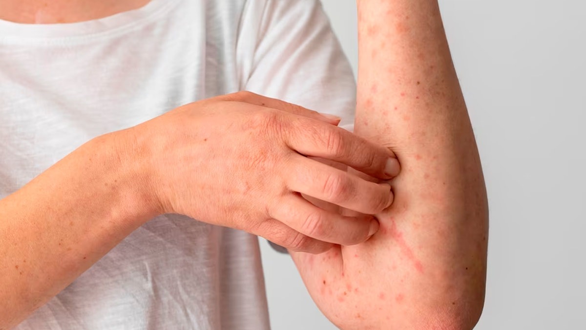 क्या आपके शरीर में हर वक्त हो रही खुजली? तो हो जाइए सावधान, कहीं ये Skin Cancer तो नहीं…