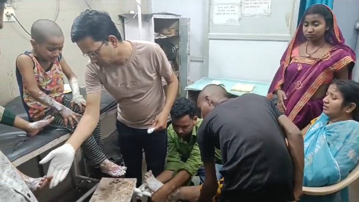 CG NEWS : दूध गर्म करते समय गैस सिलेंडर लीक होने से लगी आग, मां और दो बच्चे झुलसे