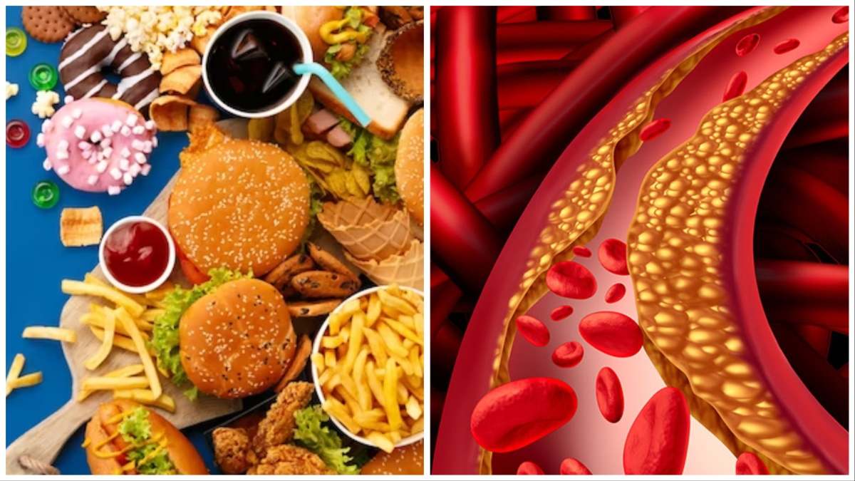 Oily और Junk Food खाने के बाद कर लें ये 5 काम, नहीं होगी High cholesterol की समस्या…