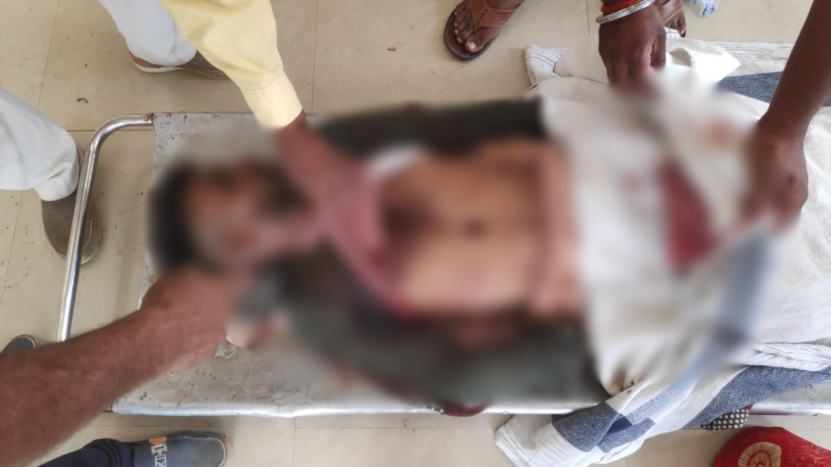 DJ पर डांस को लेकर सगे भाईयों में विवाद: दुल्हन के भाई ने पहले मिलाया हाथ, फिर चाकू से कर दिया वार, एक की मौत