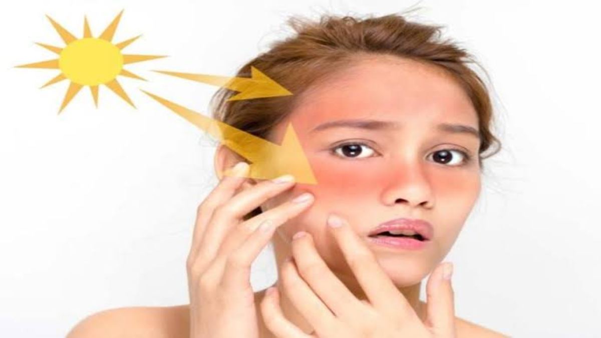 Skin care tips- तेज धूप की वजह से फेस हो गया है टैन, तो परेशान न होएं बस लगा लें ये घरेलू फेसपैक
