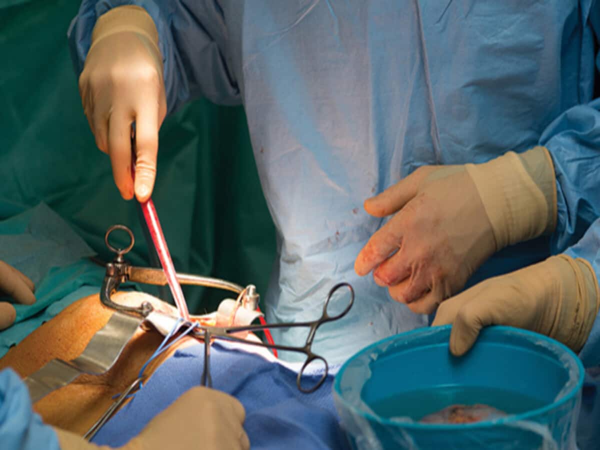 अवैध रूप से किडनी ट्रांसप्लांट करने वाले पकड़े गए, दर्ज हुआ मामला