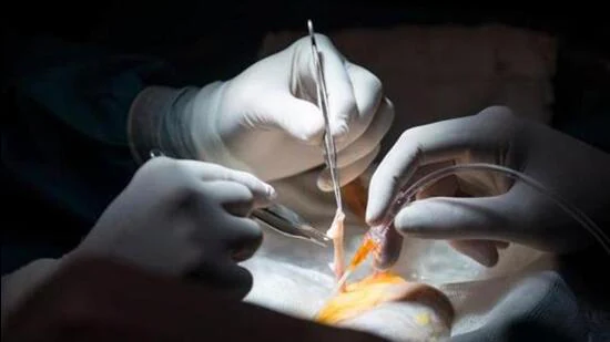 Punjab News : दाईं किडनी में थी स्टोन.. डॉ ने बाईं की कर डाली सर्जरी