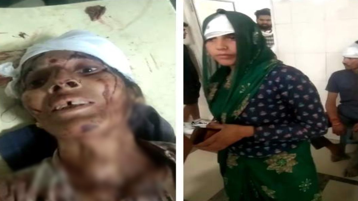 दो पक्षो में खूनी संघर्ष: चार महिला समेत 11 लोग घायल, इस बात को लेकर हुआ था विवाद