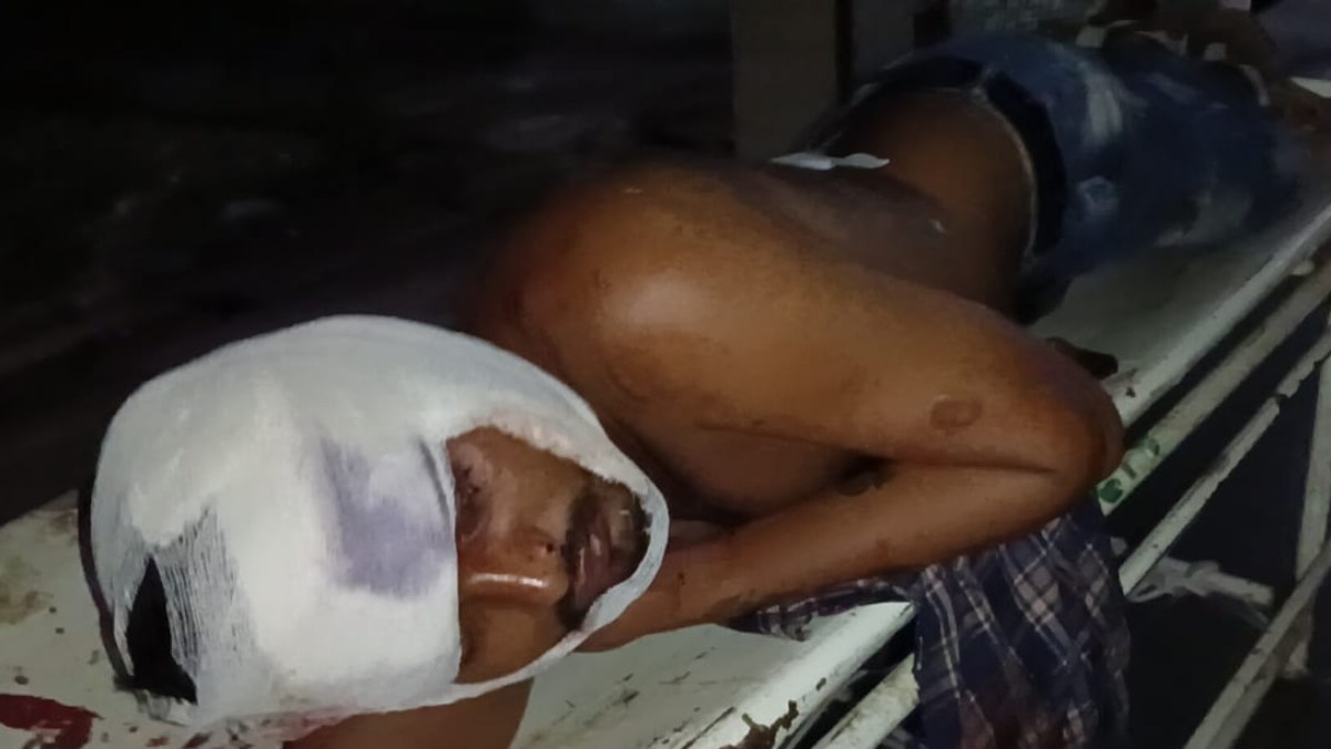 शराब के लिए पैसे न देने पर चाकू से हमला: बदमाशों ने युवक को किया लहूलुहान, चेहरे और गले पर किए ताबड़तोड़ वार