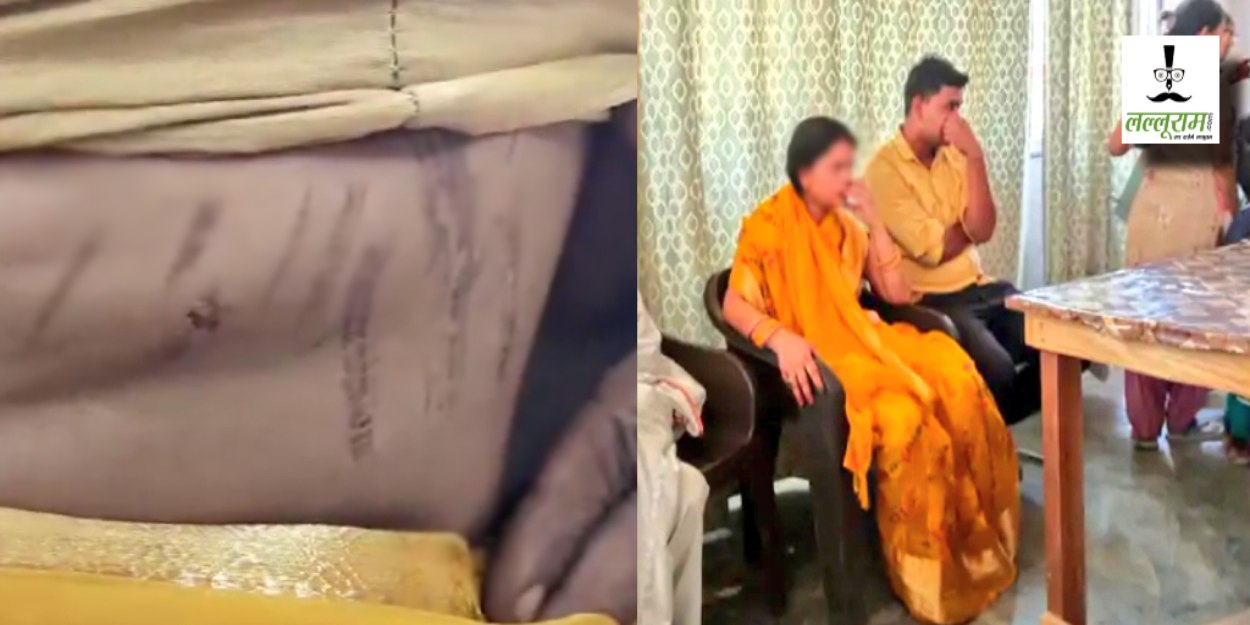 झाड़ू से पीटा फिर गर्म चिमटे से दागता… इलाज के लिए तांत्रित के पास ले गए थे जेठ-जेठानी; हालत देख उड़े होश