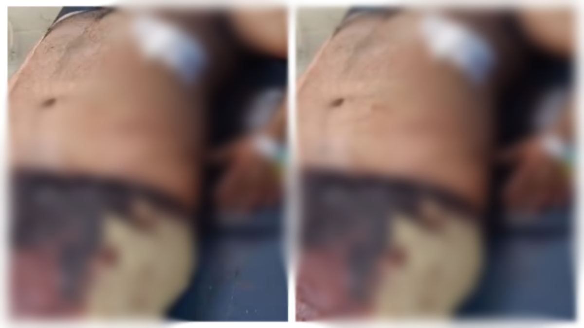 राजधानी में बदमाश बेखौफ : बाइक सवार तीन युवकों पर चाकू से किया हमला, एक की हालत गंभीर