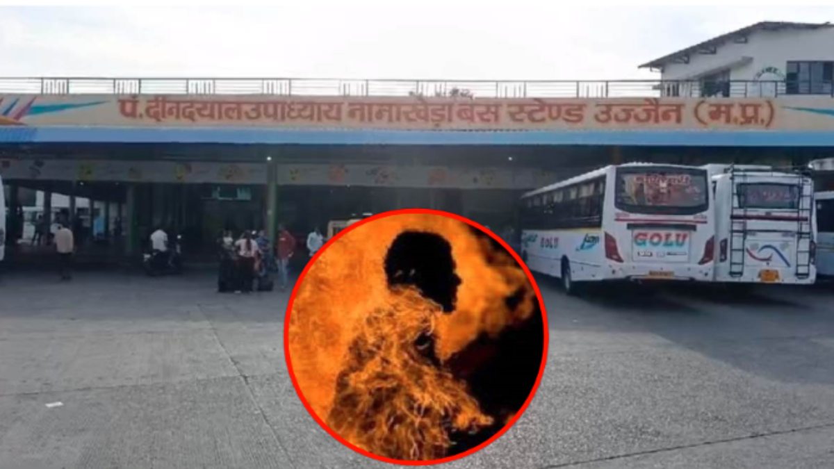 खुद पर उड़ेला पेट्रोल, दूसरे ने लगा दी आग: 40 प्रतिशत झुलसा युवक, आरोपी पहले भी जिंदा जला चुका है