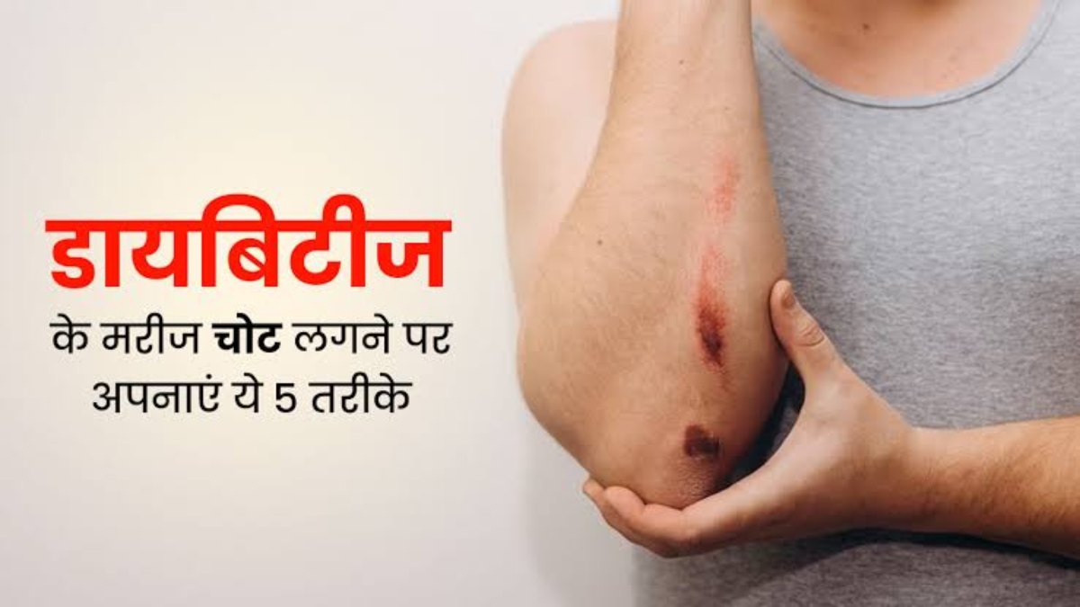Diabetes के मरीज चोट लगने पर रहे Extra सावधान, जरा-सी लापरवाही से बिगड़ सकती है आपकी तबीयत
