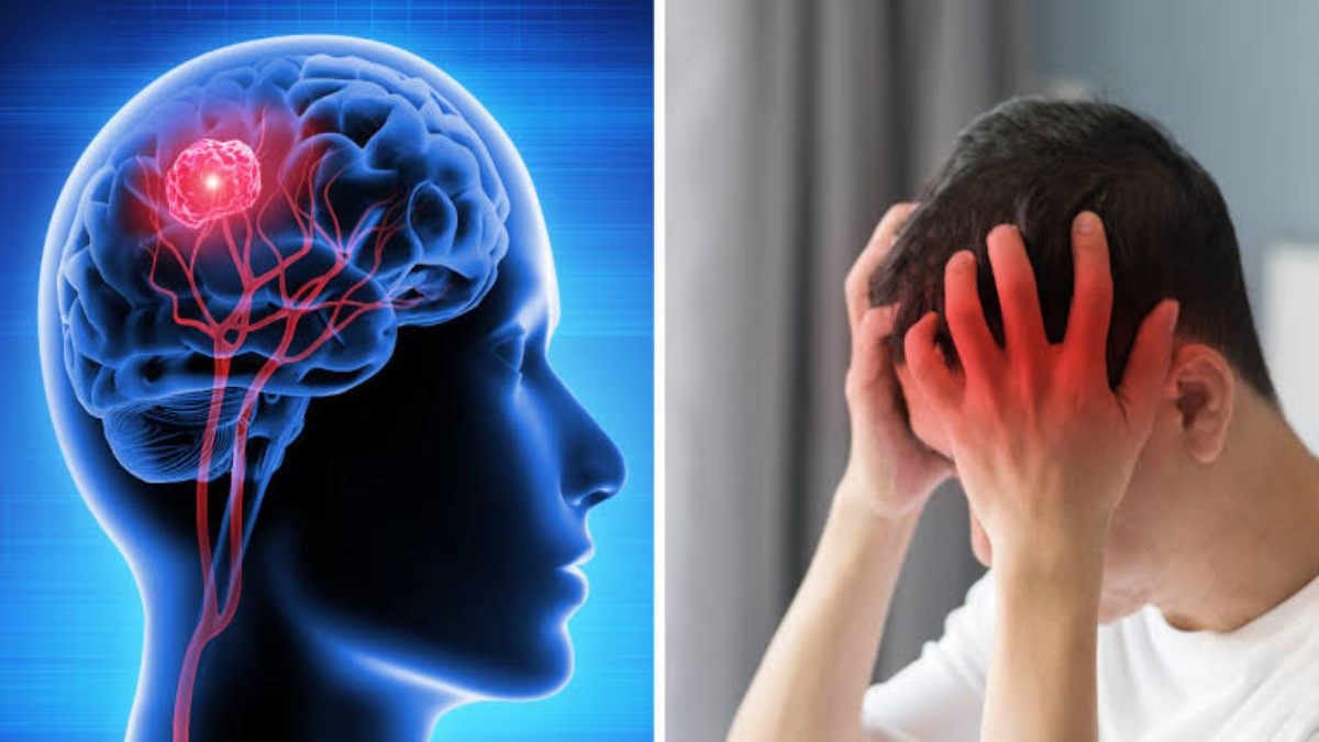 युवाओं में ब्रेन ट्यूमर की चेतावनी देने वाले इन 5 संकेतों को न करें नजरअंदाज, बढ़ सकती है समस्या…