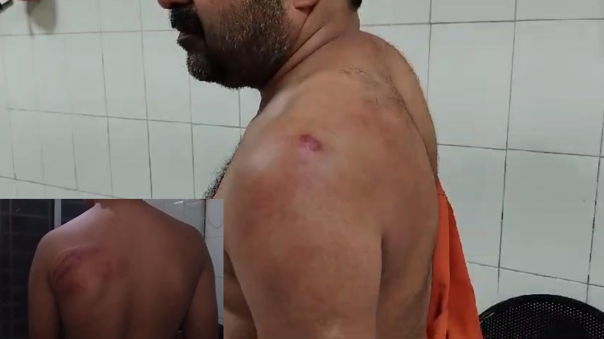 सुलभ कॉम्प्लेक्स के केयर टेकर की पिटाई: नाबालिग बेटे से भी की मारपीट, आरोपियों पर FIR दर्ज