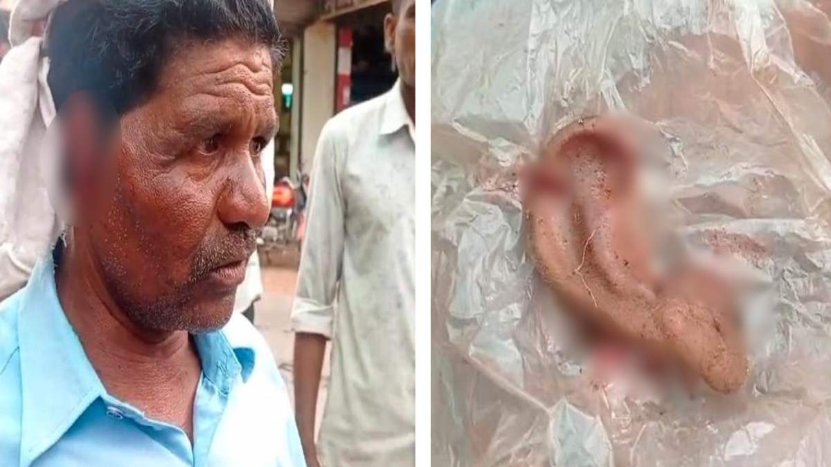 तेदुंए ने किसान का काटा कान: खेत में काम करते वक्त किया हमला, लोगों में दहशत