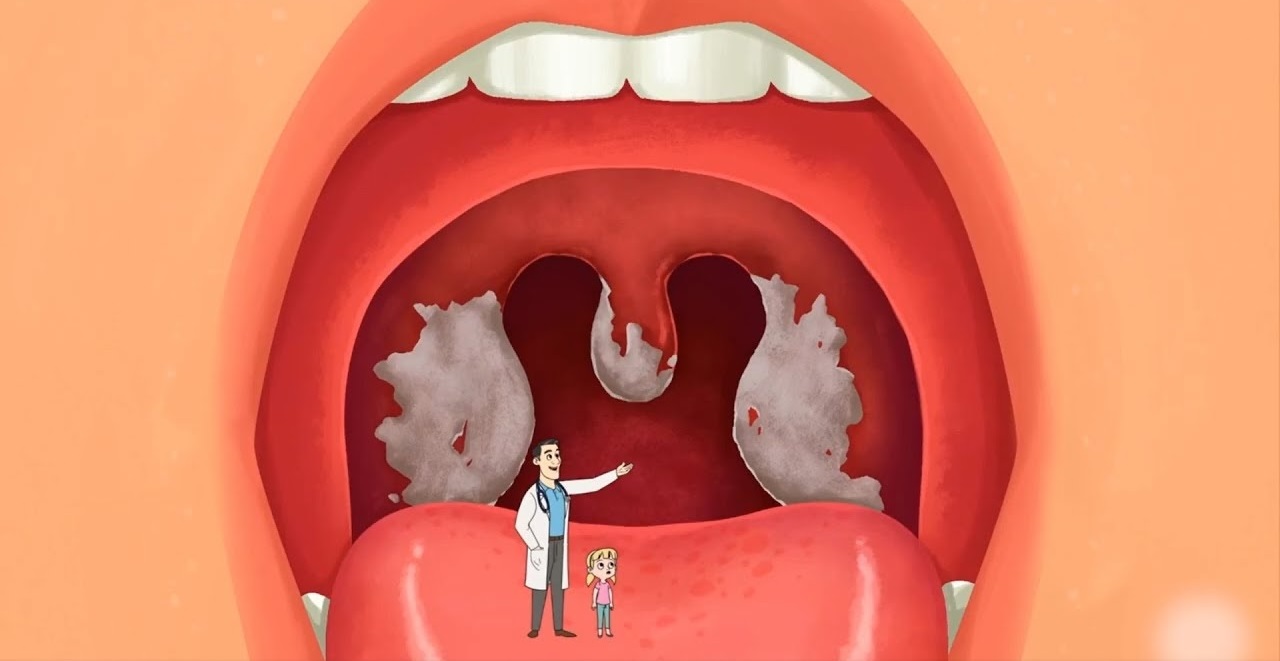 अब ये कौन सी नई बीमारी है Diphtheria! 5 मौतों के बाद CM Alert… आप भी रहें सावधान