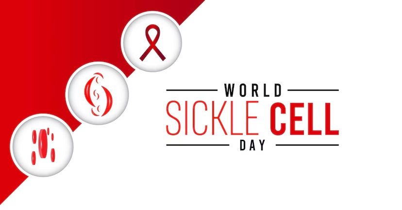 World Sickle Cell Day आज: सिकलसेल की चपेट में बस्तर, 3000 से ज्यादा पॉजीटिव मरीज