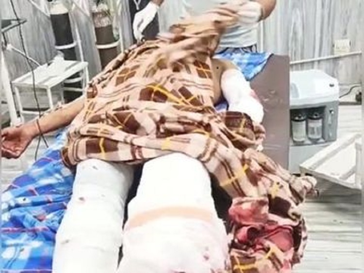 अबोहर : मां के साथ संबंध रखने वाले व्यक्ति को बेटे ने कुल्हाड़ी से बुरी तरह से काटा