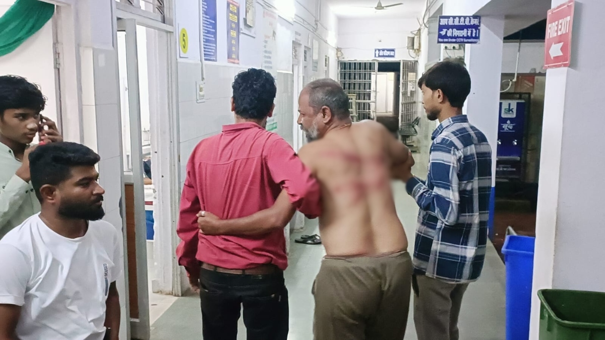 बदमाशों ने बंधक बनाकर बेहोश होते तक पीटा, फिर मोबाइल और पर्स छीनकर हुए फरार, आरोपियों की तलाश में जुटी पुलिस