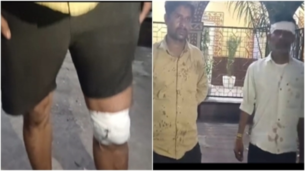 पत्रकार पर जानलेवा हमला: हाथ और पैर में आई गंभीर चोट, भू माफियाओं के खिलाफ जाना पड़ा महंगा, FIR दर्ज