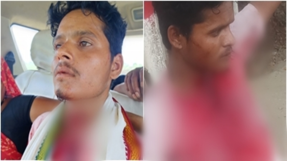 डिप्रेशन में युवक ने काटा गला: खून से लथपथ खुद पहुंचा घर, परिजनों के उड़े होश, अस्पताल में  कराया भर्ती 