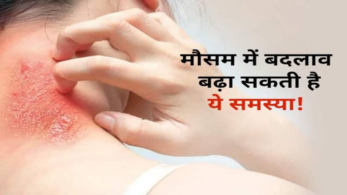मानसून में बढ़ जाता है Fungal Infection का खतरा, जाने कौन सी Healthy Habits बचाएगी हमें इंफेक्शन से…