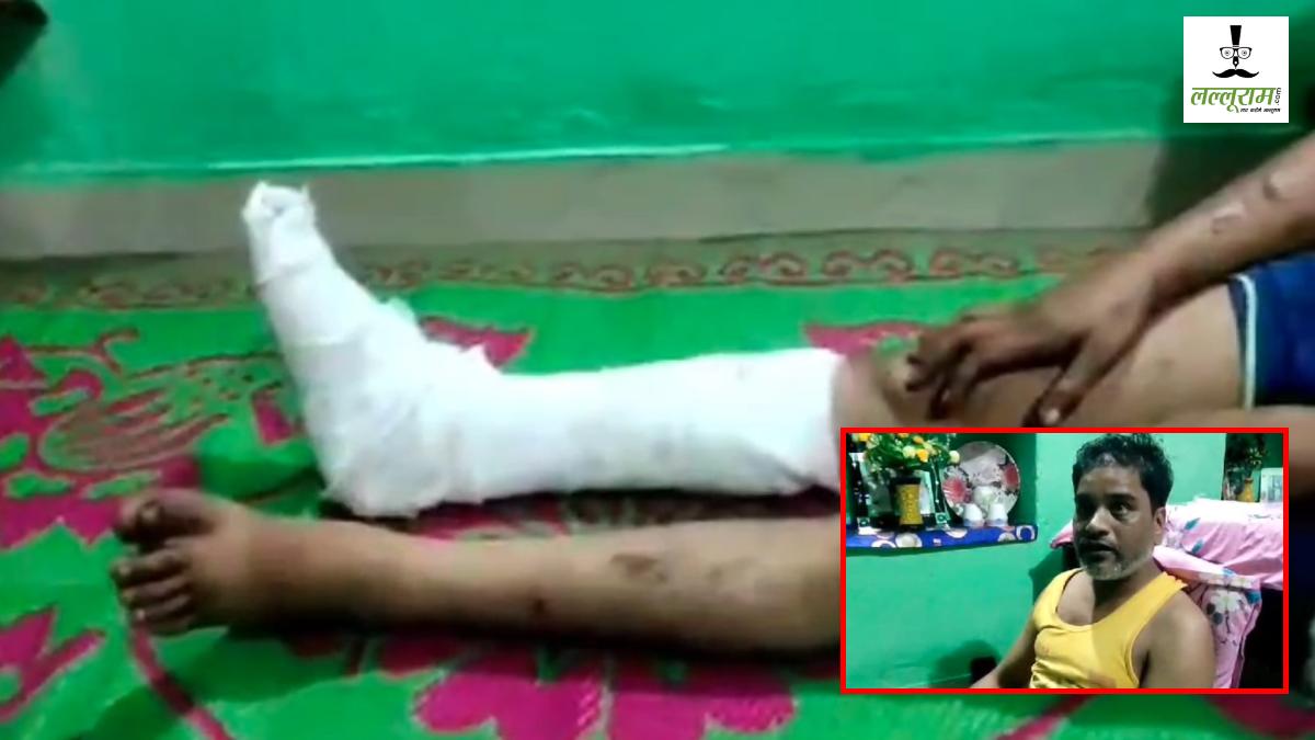 पुलिस का थर्ड डिग्री टॉर्चरः चोरी के शक में ऑटो चालक की बेरहमी से पिटाई, क्राइम ब्रांच पर पेशाब पिलाने का आरोप