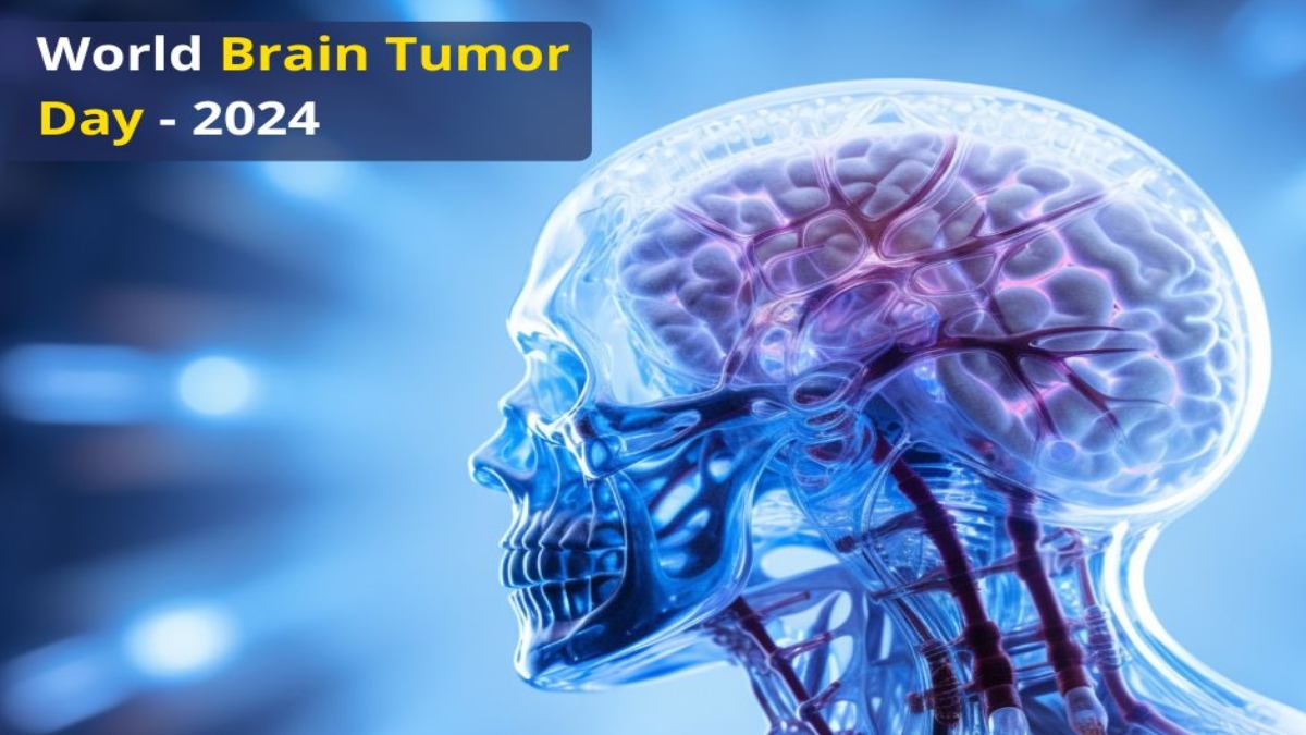 World Brain Tumor Day : एक ऐसी बीमारी, जिसका पता अक्सर काफी देर से चलता है….
